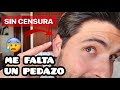 ¿QUÉ LE PASÓ A MI OREJA, Por qué le TENGO ASÍ? - Gabriel Herrera