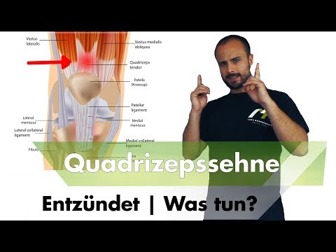 Video: 5 Wege, um Wunden im Mund zu heilen