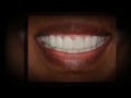 Average Cost Of Dental Implants In Ohio