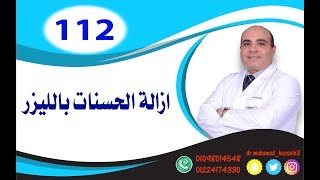 ازالة الحسنات بالليزر .. للدكتور محمد حسين - 112