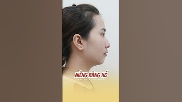 Tạm biệt hô răng & khấp khểnh, lột xác với góc nghiêng thần thánh | #shorts