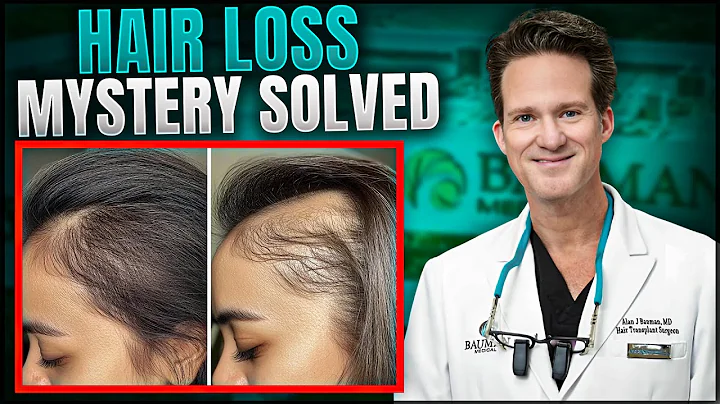 How Stress Causes Hair Loss and Natural Ways to Regrow It Fast!
