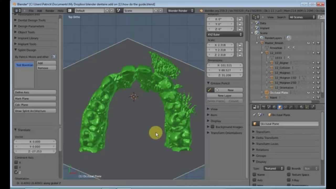 Implant Surgical Guide in Blender YouTube