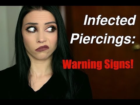 Video: Infected Lip Piercing: Symtom, Behandling, Förebyggande Och Mer