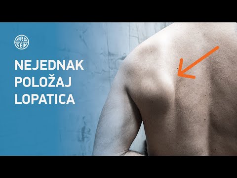 Video: Kalopanax Sa Sedam Lopatica