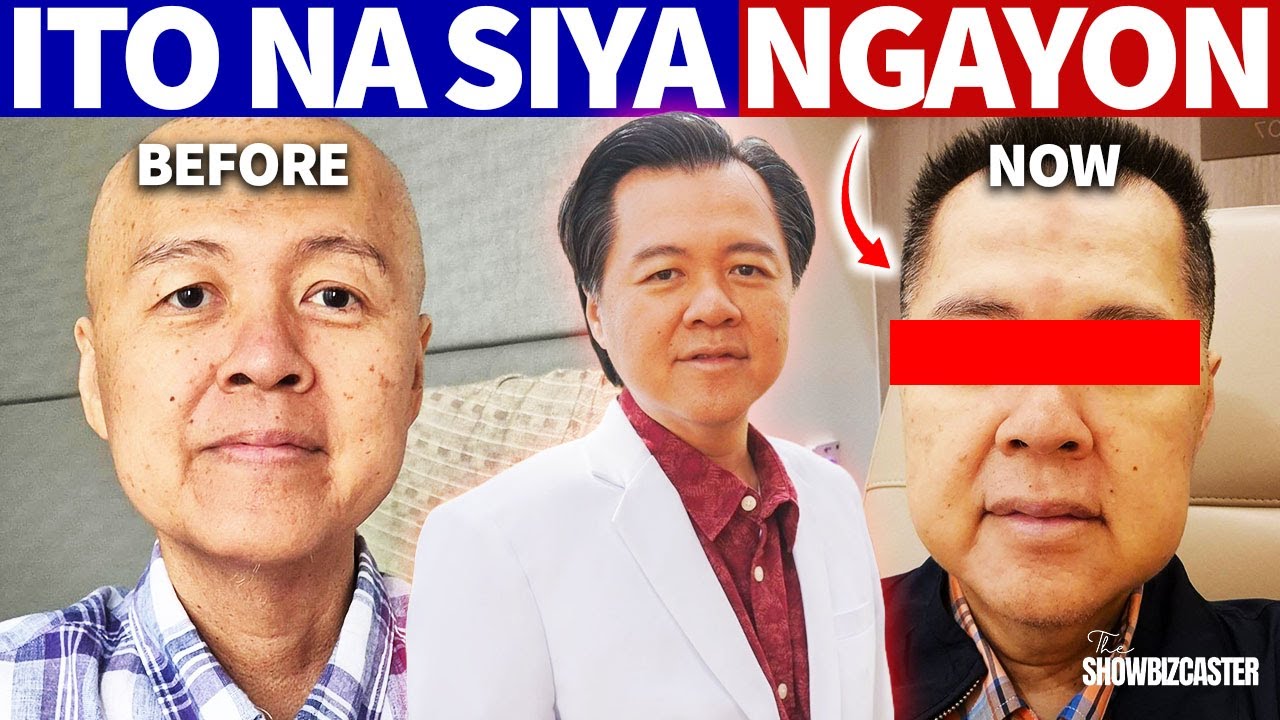 Ito na ngayon si Doc Willie Ong, Isang taon matapos ma-Cancer!