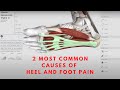 2 MOST COMMON CAUSES OF HEEL AND FOOT PAIN | Orthopedic & Balance Therapy Specialists | OBTS