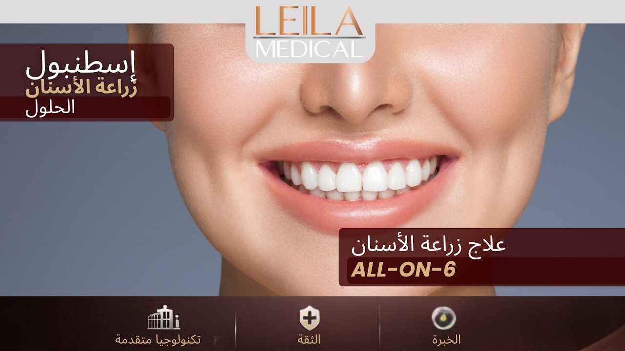 وداعًا للأطقم المتحركة، ومرحبًا بالأسنان الثابتة