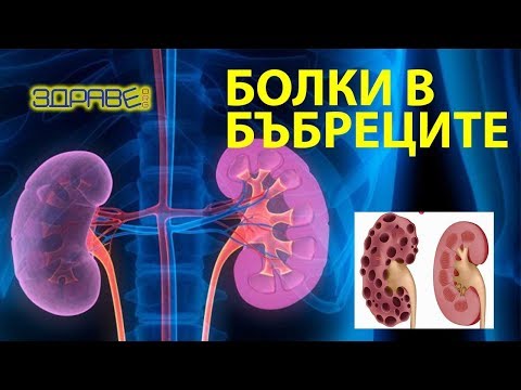 Видео: Може ли куркуминът да увреди бъбреците ви?