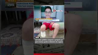 Servidor público amputa o próprio pé para tentar ganhra dinheiro de seguro