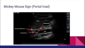 ARDMS Abdomen Registry review - IMAGE GALLERY Part1