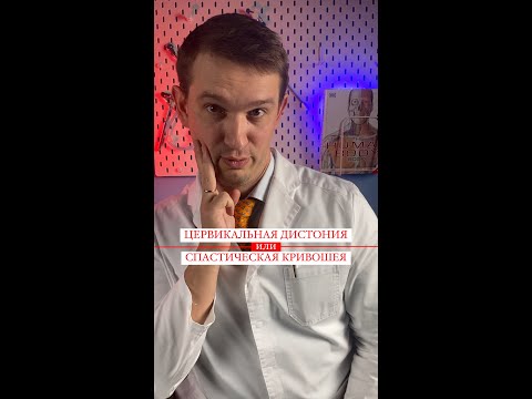 Цервикальная дистония (кривошея )