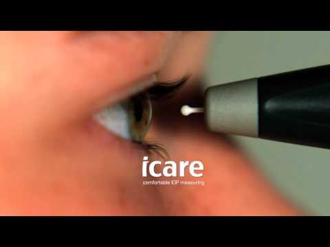 Icare Tonometer Your Patients Will Thank You For It