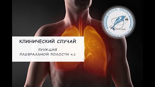 Пункция плевральной полости (Часть 1)