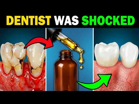 Forget Mouthwash — This Oil Kills Harmful Gum Cavities!