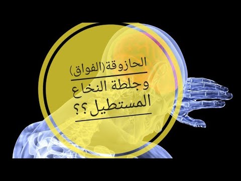 ما العلاقة بين الحازوقة والجلطة الدماغية       د سوسن ناجي ال