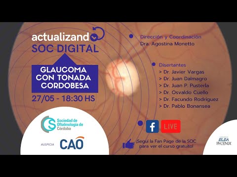 Glaucoma con tonada cordobesa - Actualizando de la SOC DIGITAL.