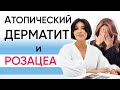 Какие диетические привычки и уход могут спасти вашу кожу