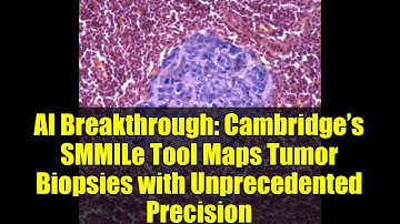 AI Breakthrough: Cambridge’s SMMILe Tool Maps Tumor Biopsies with Unprecedented Precision