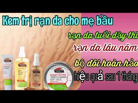 Review kem trị rạn da nào tốt Palmer's xuất xứ Mỹ