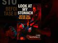 'Look at My Stomach Before You Tase Me Again'   Suspect Pleads During Arrest
