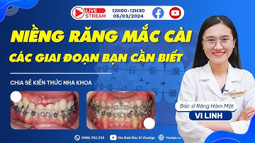 #Vinalign: Chủ đề “Các giai đoạn của niềng răng mắc cài”