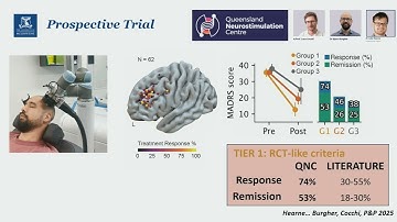 OHBM 2025 | Symposium | Robin Cash | Targeting dysfunctional circuits using brain stimulation