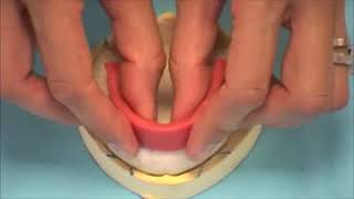 comment réaliser les bourrelets de cire en prothèse dentaire