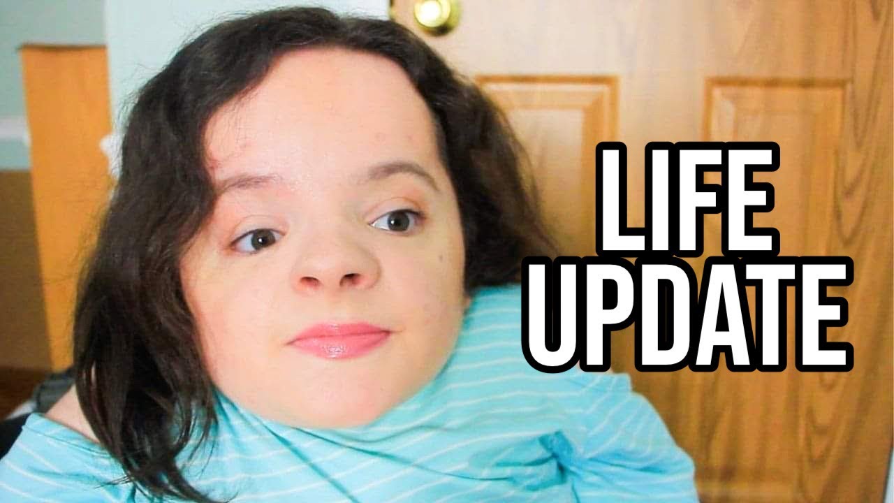 Life Update Dealing With Loss Research Fund Update And Surgery 