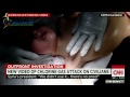 Chlorine gas attack reported in Syria Mp3 Song