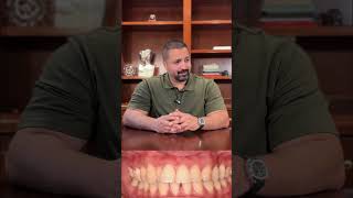 Canine substitution Vs classic options