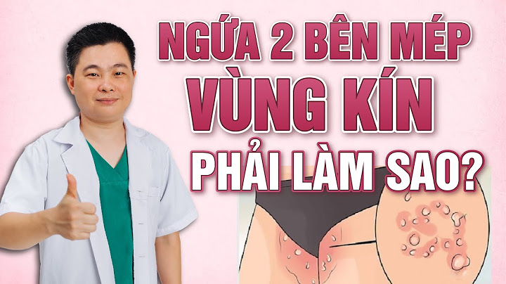 Ngứa vùng da sát môi dưới là bệnh gì