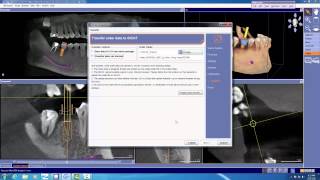 How to order the Optiguide with Cerec Omni/BlueCam's Scan screenshot 4