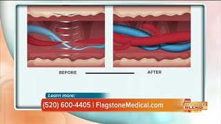 Flagstone Medical: Goodbye erectile dysfunction