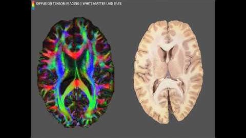 Pixel perfect - Using Image Processing to Improve Outcomes for Cancer Patients