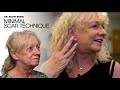 Dr. Engel Facelift _ Cheryl&#39;s Experience