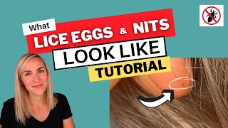 What Lice Eggs and Nits Look Like Video Tutorial