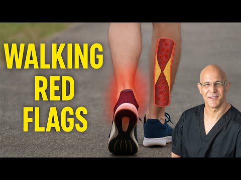 8 Walking Symptoms That Reveal Dangerous Cholesterol Levels | Dr. Mandell