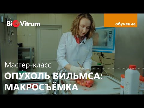 Как выглядит рак почки