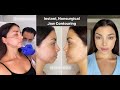 JAWLINE AND CHIN CONTOUR WITH FILLER | BEFORE AND AFTER |  Dr. SimonOurian