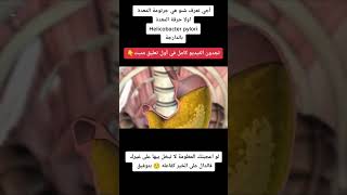 جرتومة المعدة / Helicobacter pylori / حرقة المعدة (بالدارجة)