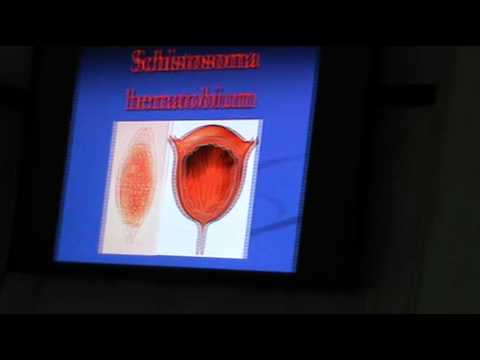 pathology journal Dr.Sahar - Parasitic Infections 1 - Bilharziasis