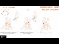 Tutoriel imosteo 6  physiopathologie et smiologie radiologique de linstabilit scapholunaire