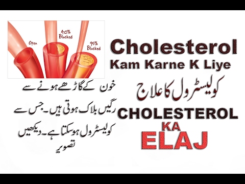 Cholesterol Diet Food Chart In Urdu