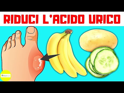 Video: 3 modi per controllare l'acido urico senza medicine