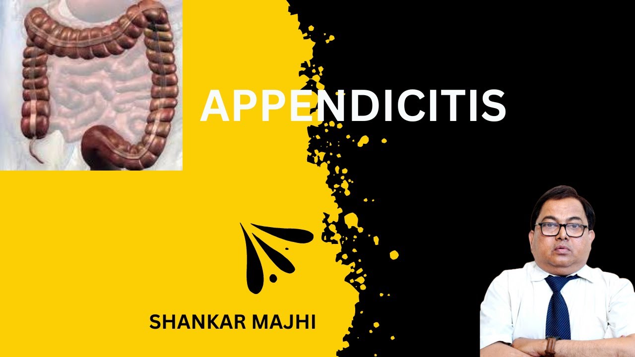 APPENDICITIS - YouTube