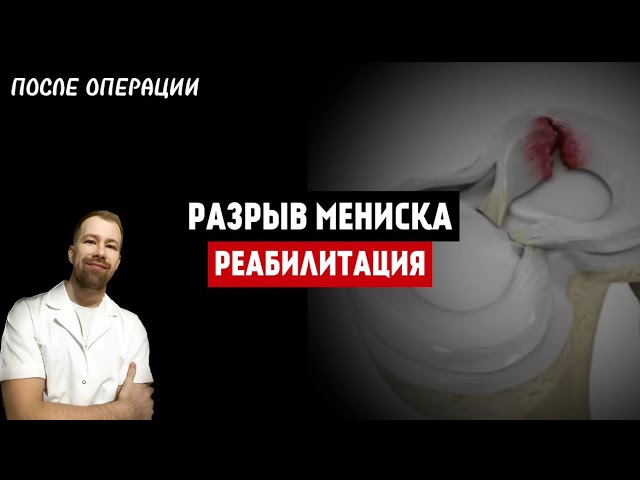 РАЗРЫВ МЕНИСКА. Реабилитация после ОПЕРАЦИИ. Реабилитация КОЛЕННОГО СУСТАВА.