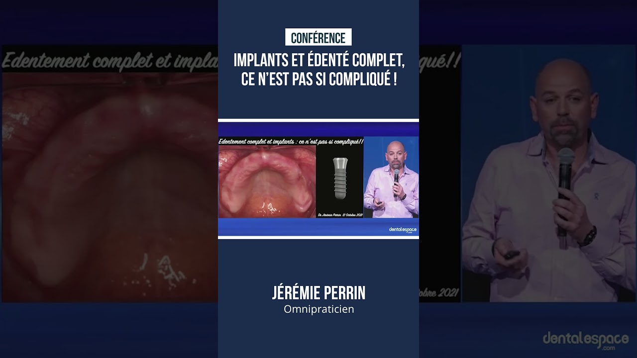 🦷 Implants et édenté complet, ce n’est pas si compliqué !