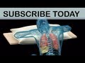 Trinsic medical animation introduction