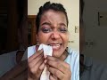 After watching this episode , you will hate makeup #makeup #removing #episode 